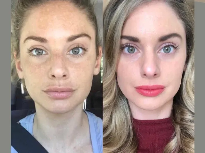 Best Aesthetic Clinic in Dubai